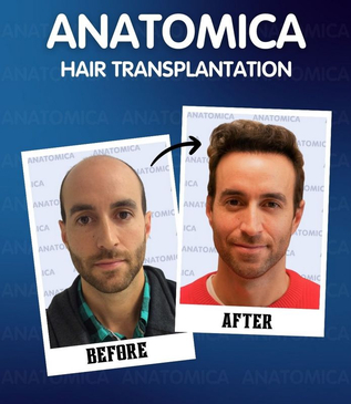 Slider image (7) Anatomica Clinic